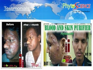 Procedure: We are the TrendmakerWe are the Trendmakers
Testimonials:
T R E N D M A S T E R S G R O U P
 