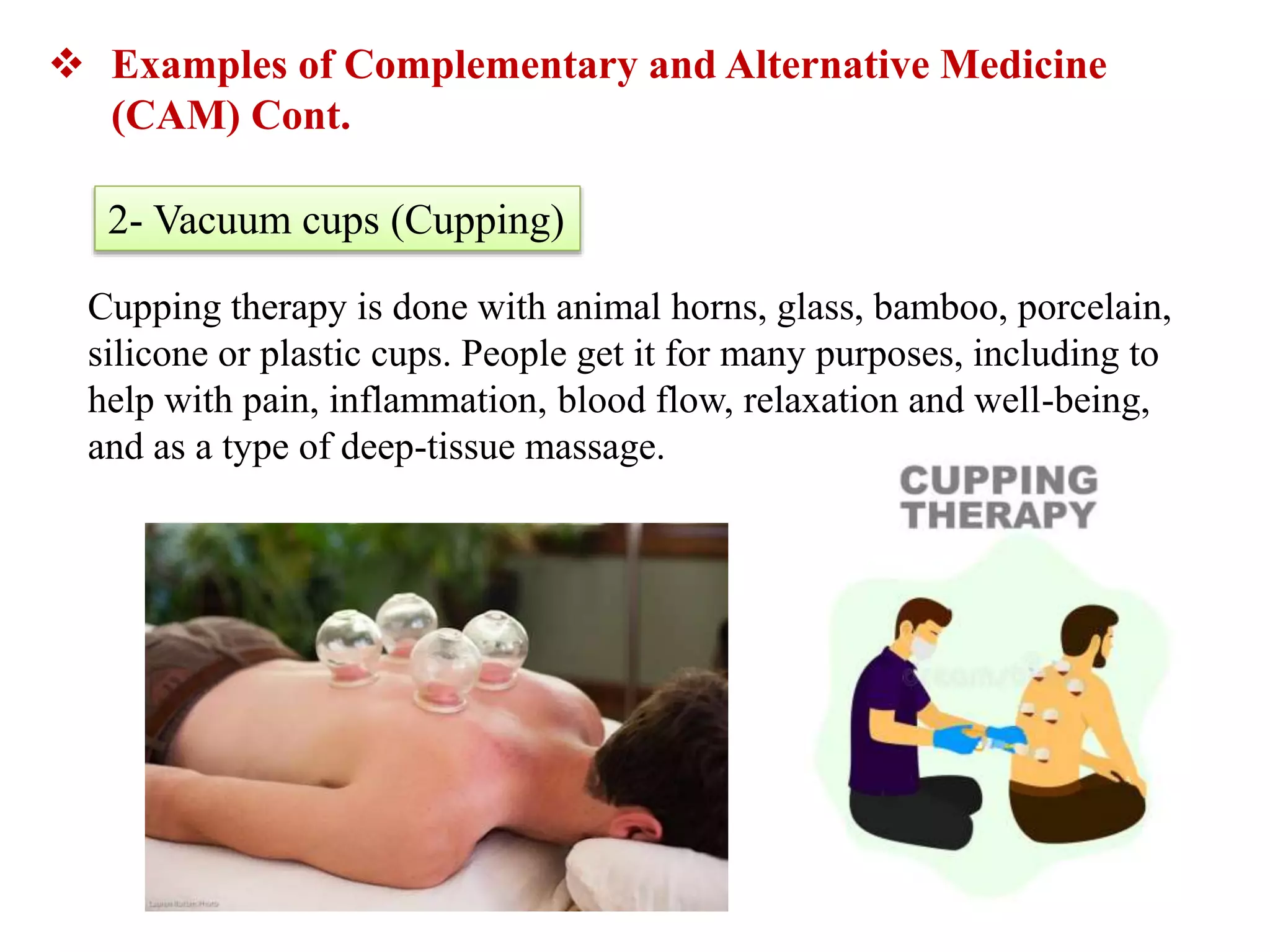 Cupping therapy is done with animal horns, glass, bamboo, porcelain,
silicone or plastic cups. People get it for many purposes, including to
help with pain, inflammation, blood flow, relaxation and well-being,
and as a type of deep-tissue massage.
 Examples of Complementary and Alternative Medicine
(CAM) Cont.
2- Vacuum cups (Cupping)
 