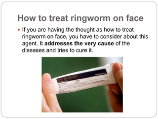 How to treat ringworm on face
If you are having the thought as how to treat
ringworm on face, you have to consider about this
agent. It addresses the very cause of the
diseases and tries to cure it.