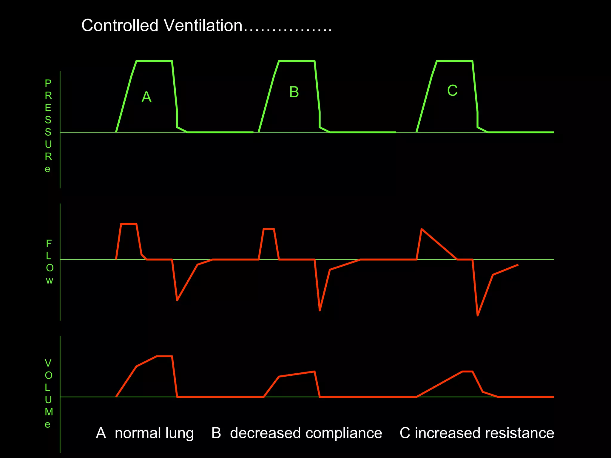 P R E S S U R e F L O w V O L U M e A B C A  normal lung  B  decreased compliance  C increased resistance  Controlled Ventilation…………….  