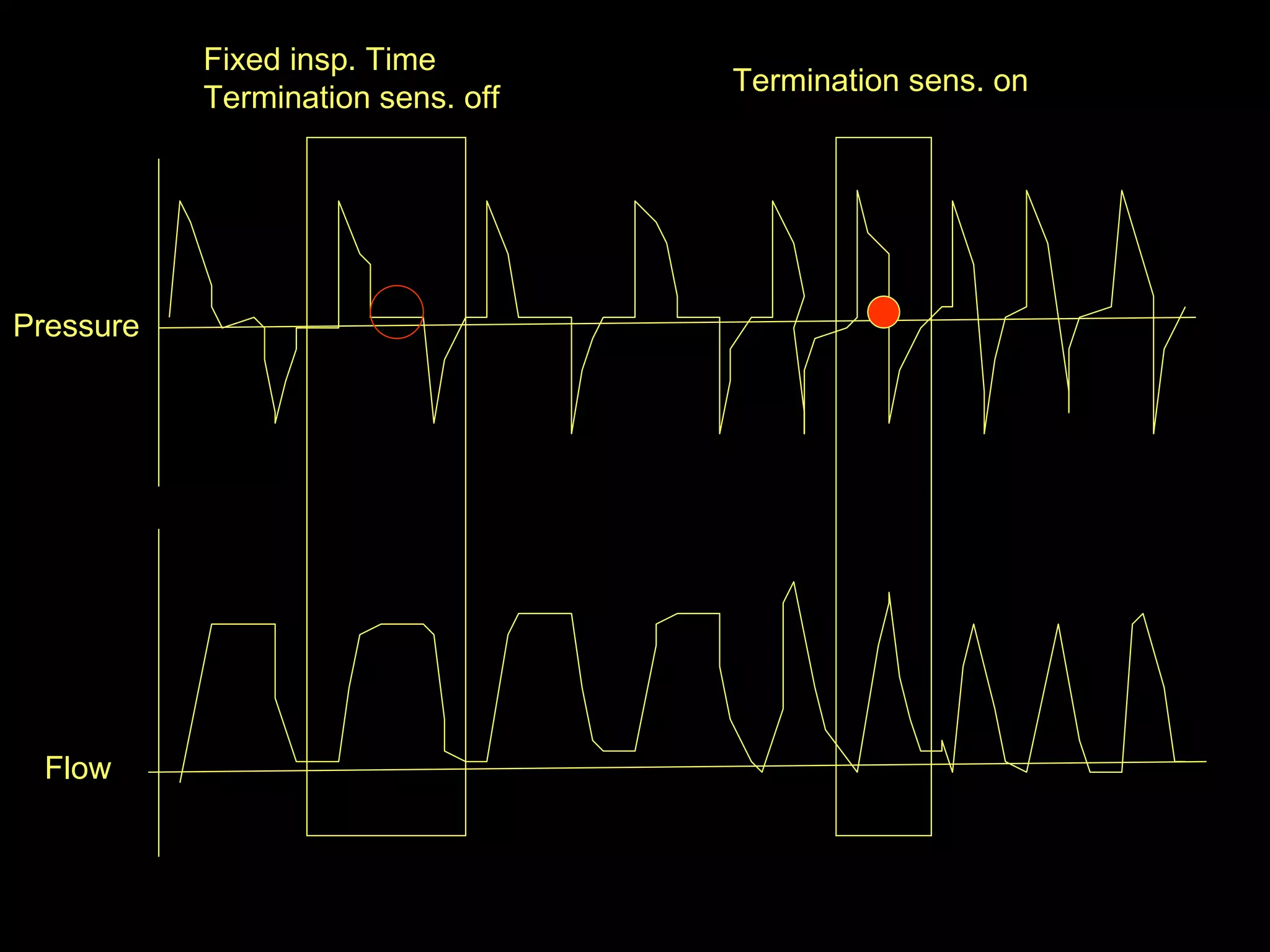 Fixed insp. Time Termination sens. off Termination sens. on Flow  Pressure 