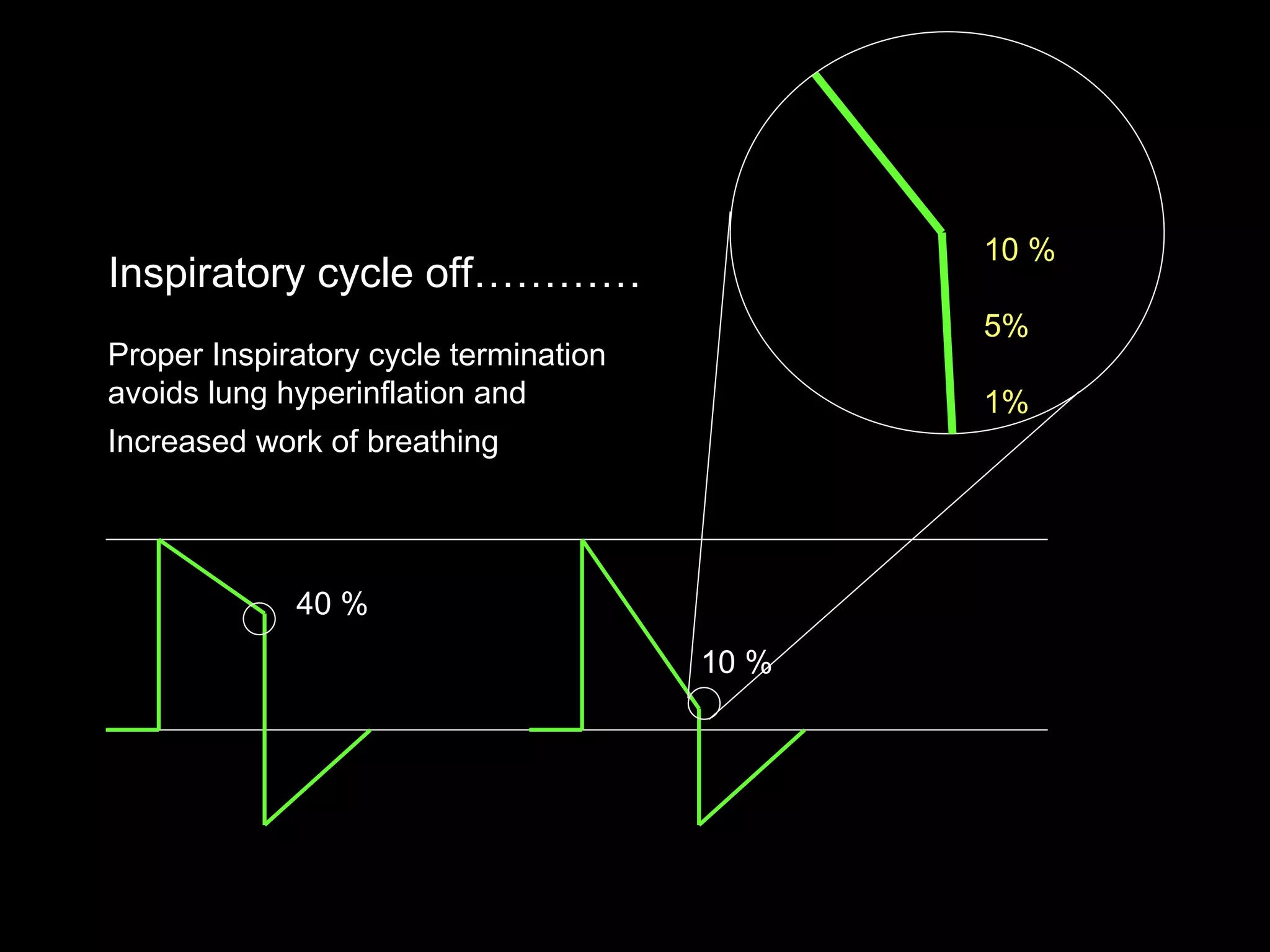 Inspiratory cycle off………… Proper Inspiratory cycle termination avoids lung hyperinflation and  Increased work of breathing   40 % 10 % 10 % 5% 1% 