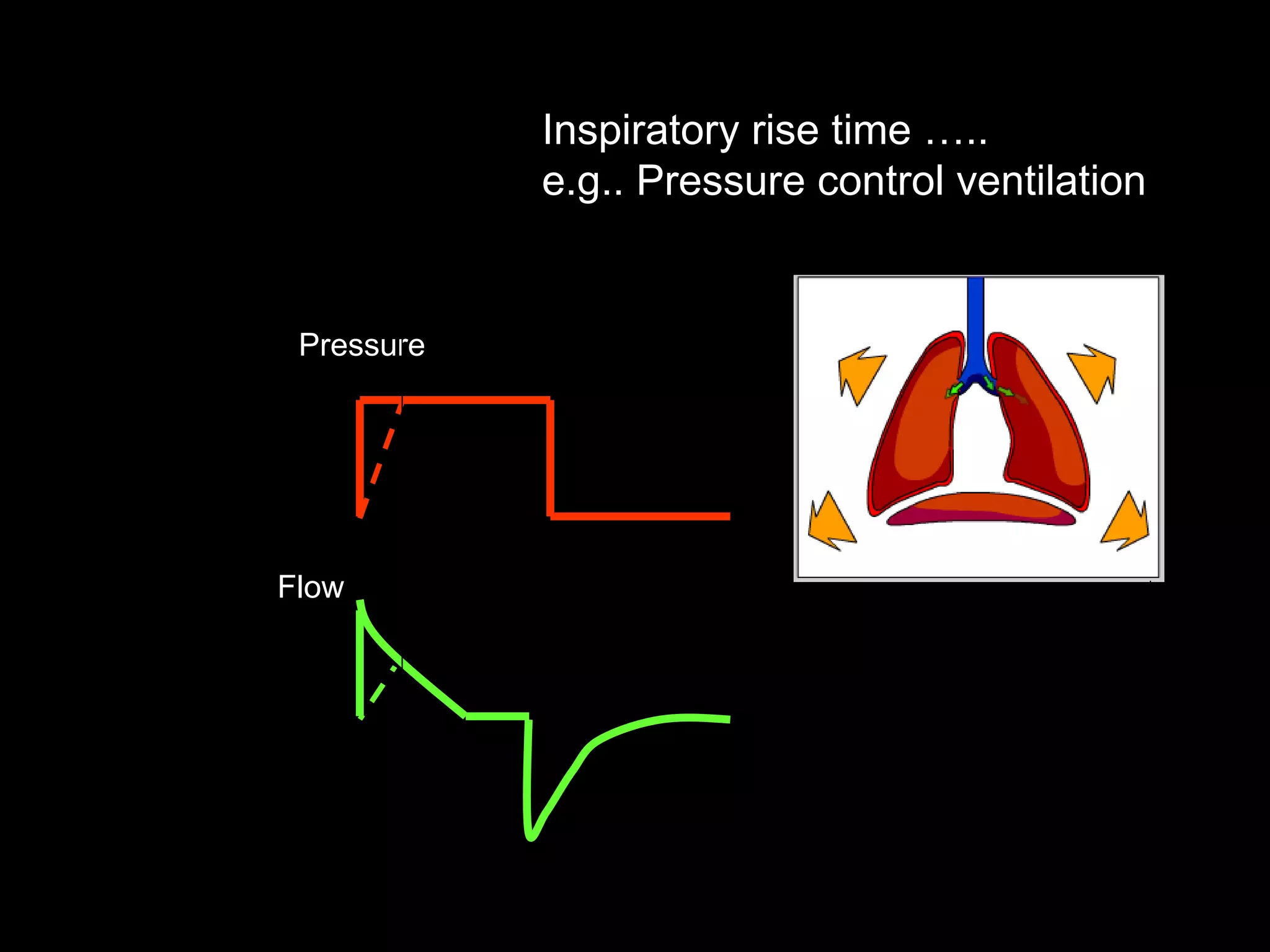 Pressure  Inspiratory rise time ….. e.g.. Pressure control ventilation Flow  