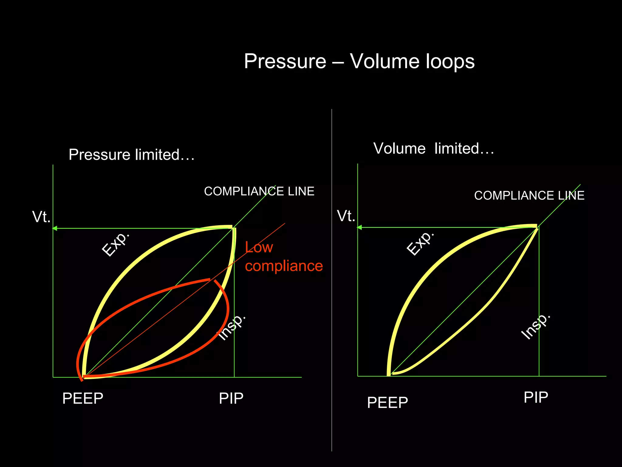 Exp. Insp. PEEP PIP Vt. COMPLIANCE LINE Pressure limited… Exp. Insp. PEEP PIP Vt. COMPLIANCE LINE Volume  limited… Pressure – Volume loops  Low  compliance 