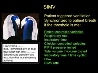 SIMV  Patient triggered ventilation Synchronized to patient breath if the threshold is met .  Patient controlled variables   Respiratory rate Inspiratory time  Clinician controlled variables   PIP if pressure limited  Tidal volume if volume cycled  Inspiratory time if time cycled Flow  SIMV rate  Flow cycling ……. Insp. Terminated at % of peak  flow rather than time…………  Synchronizes expiratory and  Insp. flow thus total synchrony  achieved .  