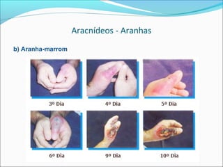 Aracnídeos - Aranhas
b) Aranha-marrom
 
