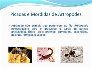 Picadas e Mordidas de Artrópodes

 Artrópode são animais que pertencem ao filo Arthropoda
 (exoesqueleto duro e articulado e pares de pernas
 articuladas). Entre eles: aranhas, carrapatos, escorpiões,
 abelhas, formigas e vespas.
 