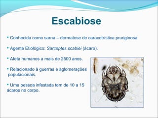 Escabiose
 Conhecida como sarna – dermatose de caracetrística pruriginosa.

 Agente Etiológico: Sarcoptes scabiei (ácaro).

 Afeta humanos a mais de 2500 anos.

 Relacionado à guerras e aglomerações
 populacionais.

 Uma pessoa infestada tem de 10 a 15
ácaros no corpo.
 