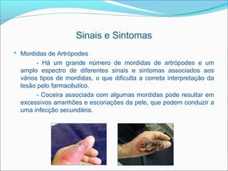 Sinais e Sintomas
 Mordidas de Artrópodes
        - Há um grande número de mordidas de artrópodes e um
  amplo espectro de diferentes sinais e sintomas associados aos
  vários tipos de mordidas, o que dificulta a correta interpretação da
  lesão pelo farmacêutico.
        - Coceira associada com algumas mordidas pode resultar em
  excessivos arranhões e escoriações da pele, que podem conduzir a
  uma infecção secundária.
 
