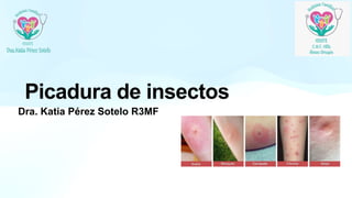 Picadura de insectos
Dra. Katia Pérez Sotelo R3MF
 