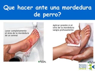 Que hacer ante una mordedura
de perro?
 