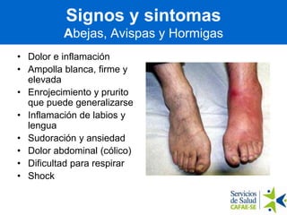 Signos y sintomas
Abejas, Avispas y Hormigas
• Dolor e inflamación
• Ampolla blanca, firme y
elevada
• Enrojecimiento y prurito
que puede generalizarse
• Inflamación de labios y
lengua
• Sudoración y ansiedad
• Dolor abdominal (cólico)
• Dificultad para respirar
• Shock
 