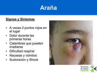 Araña
Signos y Síntomas
• A veces 2 puntos rojos en
el lugar
• Dolor durante las
primeras horas
• Calambres que pueden
irradiarse
• Dificultad respirar
• Nauseas y vómitos
• Sudoración y Shock
 
