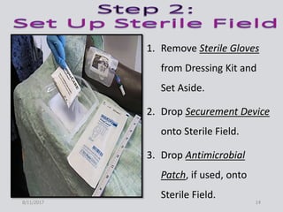 1. Remove Sterile Gloves
from Dressing Kit and
Set Aside.
2. Drop Securement Device
onto Sterile Field.
3. Drop Antimicrobial
Patch, if used, onto
Sterile Field.
8/11/2017 14
 