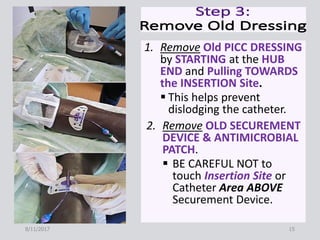 1. Remove Old PICC DRESSING
by STARTING at the HUB
END and Pulling TOWARDS
the INSERTION Site.
 This helps prevent
dislodging the catheter.
2. Remove OLD SECUREMENT
DEVICE & ANTIMICROBIAL
PATCH.
 BE CAREFUL NOT to
touch Insertion Site or
Catheter Area ABOVE
Securement Device.
8/11/2017 15
 
