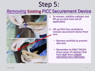 1. To remove, stabilize catheter and
lift up on each clear tab (if
applicable).
2. Lift up PICC line carefully to
remove securement device from
arm.
• Remove carefully to prevent
skin tear.
• Remember to ONLY TOUCH
those areas of catheter that
have NOT been UNDER
PREVIOUS PICC DRESSING.
8/11/2017 17
 