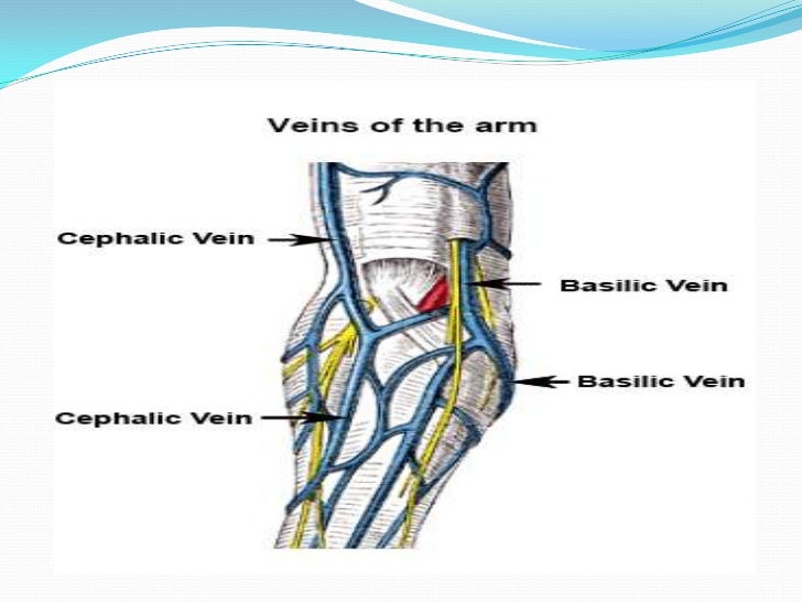 Picc line by abdul fatah
