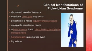z Clinical Manifestations of
Pickwickian Syndrome
 decreased exercise tolerance
 exertional chest pain may occur
 presence of a raised jugular venous pressure
 a palpable parasternal heave
 a heart murmur due to blood leaking through the
tricuspid valve
 hepatomegaly (an enlarged liver)
 leg edema
 