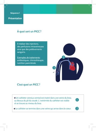 Séquence 1
Présentation
À quoi sert un PICC ?
À réaliser des injections,
des perfusions intraveineuses
ainsi que des prélèvements
sanguins.
Exemples de traitements :
antibiotiques, chimiothérapie,
nutrition parentérale.
C’est quoi un PICC ?
Un cathéter veineux central est inséré dans une veine du bras,
au dessus du pli du coude. L ‘ extrémité du cathéter est visible
et se trouve au niveau du bras.
Le cathéter se termine dans une veine qui arrive dans le cœur.
Ë
Ë
1
2
1
2
 