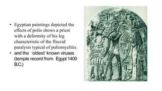 • Egyptian paintings depicted the
effects of polio shows a priest
with a deformity of his leg
characteristic of the flaccid
paralysis typical of poliomyelitis.
• and the ‘oldest’ known viruses
(temple record from Egypt 1400
B.C.)
 
