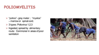 POLIOMYELITIS
 “polios”- gray mater ; “myelos”
– marrowor spinal cord.
 3 types: Poliovirus 1,2,3
 Ingested, spread by alimentary
route: Commoner in areas of poor
sanitation
 