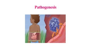 Pathogenesis
 