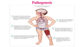 Pathogenesis
 