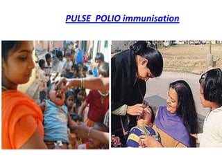PULSE POLIO immunisation
 