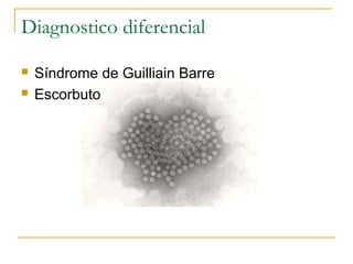 Diagnostico diferencial
 Síndrome de Guilliain Barre
 Escorbuto
 