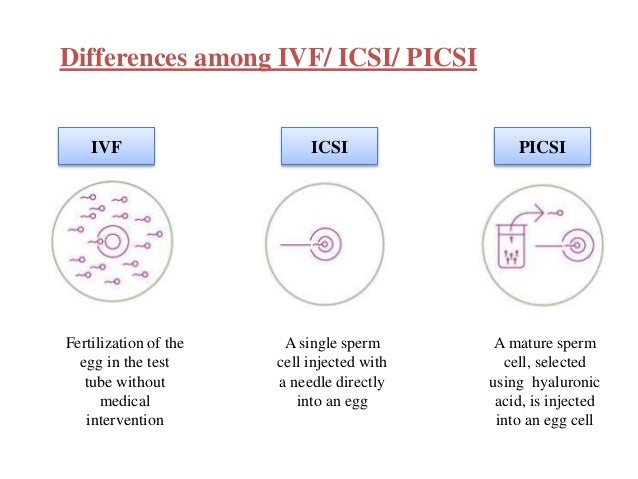 PICSI IVF Physiological intracytoplasmic sperm injection