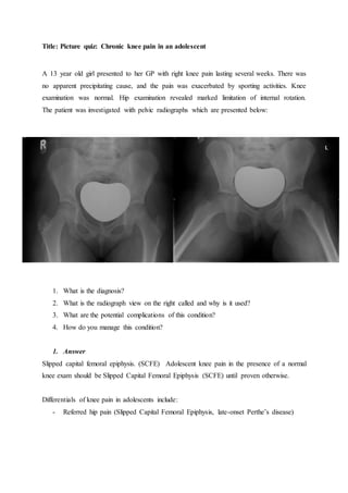 Title: Picture quiz: Chronic knee pain in an adolescent
A 13 year old girl presented to her GP with right knee pain lasting several weeks. There was
no apparent precipitating cause, and the pain was exacerbated by sporting activities. Knee
examination was normal. Hip examination revealed marked limitation of internal rotation.
The patient was investigated with pelvic radiographs which are presented below:
1. What is the diagnosis?
2. What is the radiograph view on the right called and why is it used?
3. What are the potential complications of this condition?
4. How do you manage this condition?
1. Answer
Slipped capital femoral epiphysis. (SCFE) Adolescent knee pain in the presence of a normal
knee exam should be Slipped Capital Femoral Epiphysis (SCFE) until proven otherwise.
Differentials of knee pain in adolescents include:
- Referred hip pain (Slipped Capital Femoral Epiphysis, late-onset Perthe’s disease)
 