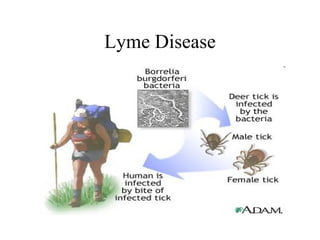 Lyme Disease 