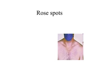 Rose spots 