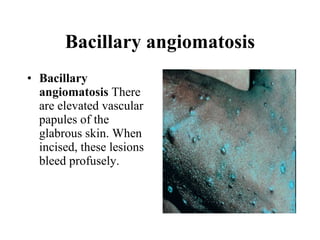 Bacillary angiomatosis Bacillary angiomatosis  There are elevated vascular papules of the glabrous skin. When incised, these lesions bleed profusely.  