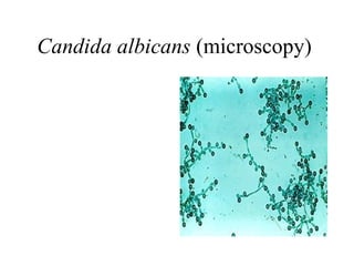 Candida albicans  (microscopy)  