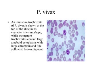 P. vivax An immature trophozoite of P. vivax is shown at the top of the slide in its characteristic ring shape, while the mature trophozoites contain large ameboid cytoplasms with large chromatin and fine yellowish brown pigment.  