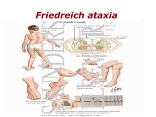 Friedreich ataxia   