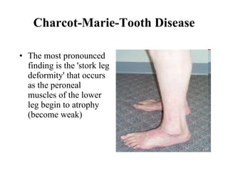Charcot-Marie-Tooth Disease The most pronounced finding is the 'stork leg deformity' that occurs as the peroneal muscles of the lower leg begin to atrophy (become weak)  