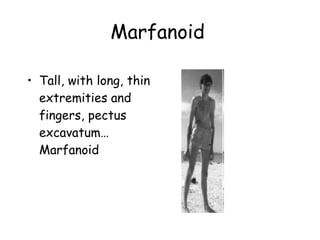 Marfanoid   Tall, with long, thin extremities and fingers, pectus excavatum…Marfanoid   