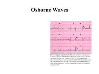 Osborne Waves 