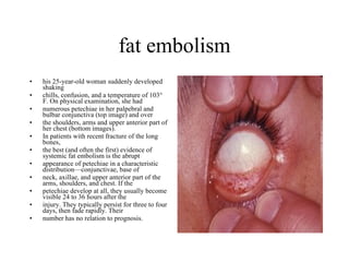 fat embolism his 25-year-old woman suddenly developed shaking  chills, confusion, and a temperature of 103° F. On physical examination, she had  numerous petechiae in her palpebral and bulbar conjunctiva (top image) and over  the shoulders, arms and upper anterior part of her chest (bottom images). In patients with recent fracture of the long bones,  the best (and often the first) evidence of systemic fat embolism is the abrupt  appearance of petechiae in a characteristic distribution—conjunctivae, base of  neck, axillae, and upper anterior part of the arms, shoulders, and chest. If the  petechiae develop at all, they usually become visible 24 to 36 hours after the  injury. They typically persist for three to four days, then fade rapidly. Their  number has no relation to prognosis. 