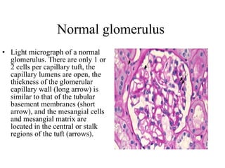 Normal glomerulus  Light micrograph of a normal glomerulus. There are only 1 or 2 cells per capillary tuft, the capillary lumens are open, the thickness of the glomerular capillary wall (long arrow) is similar to that of the tubular basement membranes (short arrow), and the mesangial cells and mesangial matrix are located in the central or stalk regions of the tuft (arrows).  