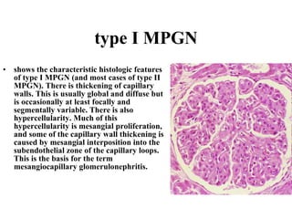 type I MPGN shows the characteristic histologic features of type I MPGN (and most cases of type II MPGN). There is thickening of capillary walls. This is usually global and diffuse but is occasionally at least focally and segmentally variable. There is also hypercellularity. Much of this hypercellularity is mesangial proliferation, and some of the capillary wall thickening is caused by mesangial interposition into the subendothelial zone of the capillary loops. This is the basis for the term mesangiocapillary glomerulonephritis.  