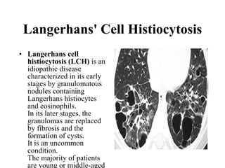 Langerhans' Cell Histiocytosis Langerhans cell histiocytosis (LCH)  is an idiopathic disease characterized in its early stages by granulomatous nodules containing Langerhans histiocytes and eosinophils.  In its later stages, the granulomas are replaced by fibrosis and the formation of cysts. It is an uncommon condition.  The majority of patients are young or middle-aged adults presenting with nonspecific symptoms of cough and dyspnea. Up to 20% of patients present with pneumothorax and over 90% of patients are smokers. Most cysts appear round, but can also have bizarre shapes (bilobed or clover-leaf shaped). An upper lobe predominance in the size and number of cysts is common.  