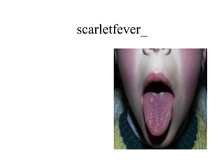 scarletfever_ 