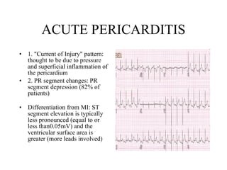 ACUTE PERICARDITIS 1. "Current of Injury" pattern: thought to be due to pressure and superficial inflammation of the pericardium  2. PR segment changes: PR segment depression (82% of patients)  Differentiation from MI: ST segment elevation is typically less pronounced (equal to or less than0.05mV) and the ventricular surface area is greater (more leads involved) 
