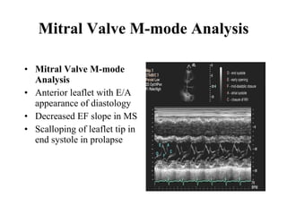 Mitral Valve M-mode Analysis Mitral Valve M-mode Analysis Anterior leaflet with E/A appearance of diastology  Decreased EF slope in MS  Scalloping of leaflet tip in end systole in prolapse  