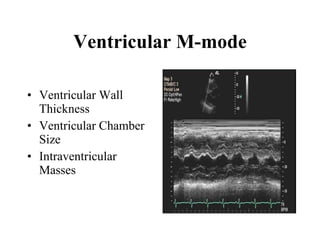 Ventricular M-mode Ventricular Wall Thickness  Ventricular Chamber Size  Intraventricular Masses  