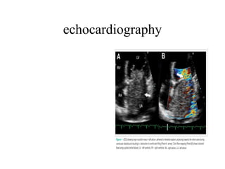 echocardiography 