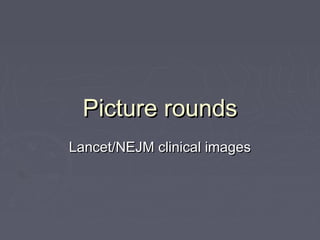 Picture roundsPicture rounds
Lancet/NEJM clinical imagesLancet/NEJM clinical images
 